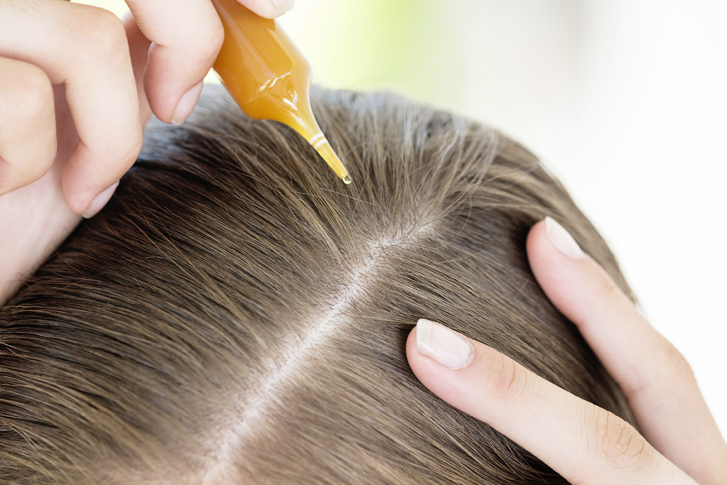Лечение волос ботоксом: ультраэффективная процедура